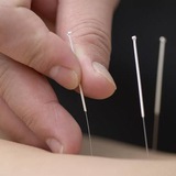 4321 basic acupuncture 4321 basic acupuncture
